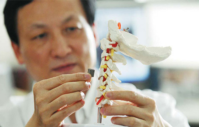 Peking University Implants First 3D Printed Vertebra